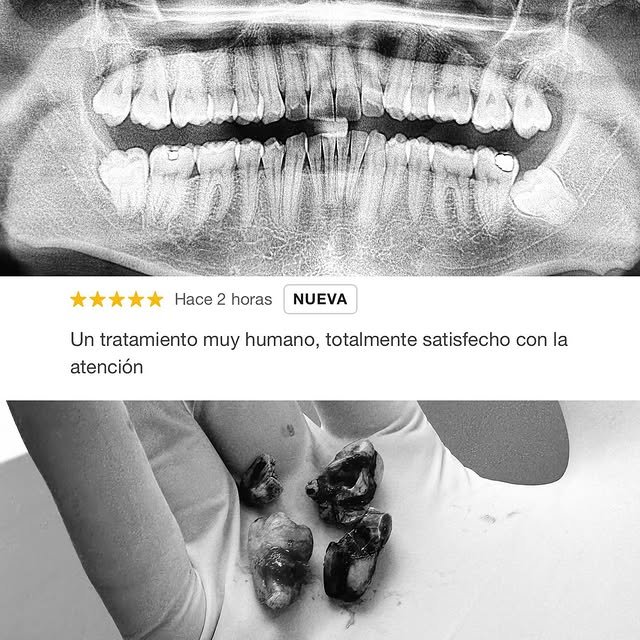 Reseña de paciente con radiografía